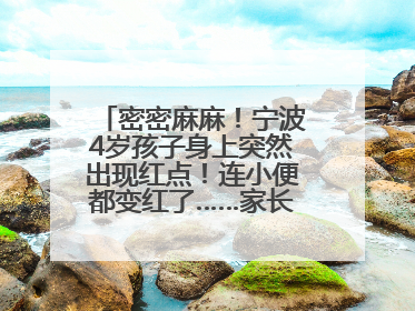 密密麻麻！宁波4岁孩子身上突然出现红点！连小便都变红了……家长：以为只是摔伤
